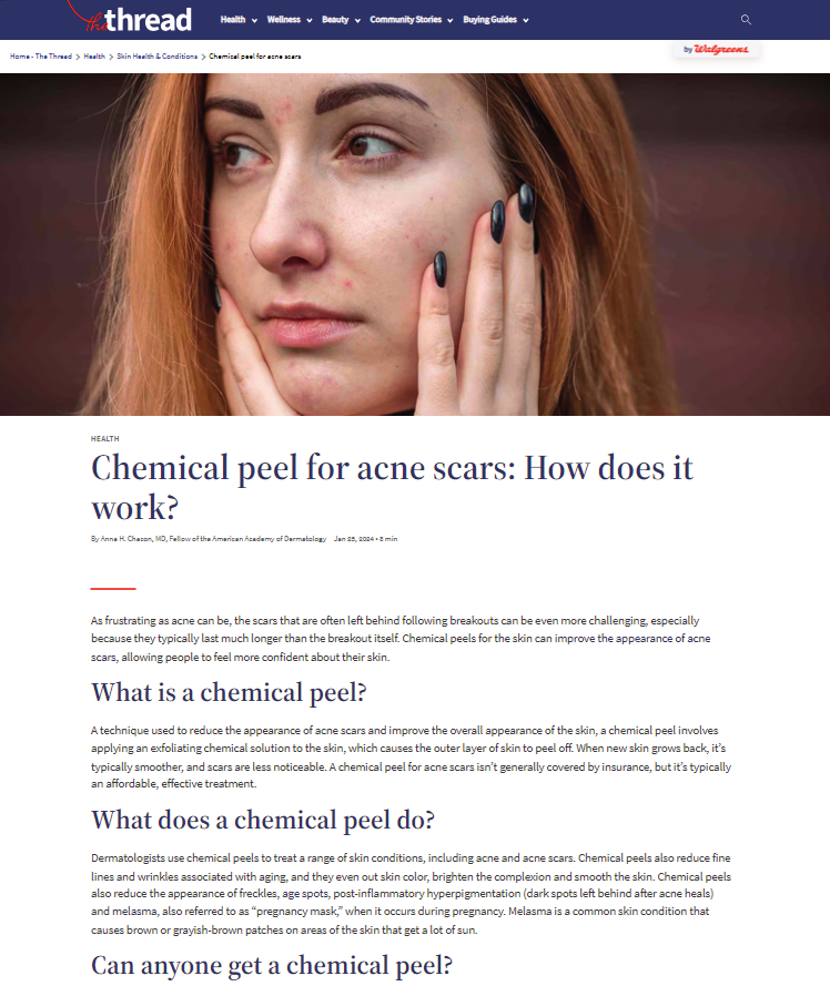 Walgreens Thread article about chemical peels for acne scars